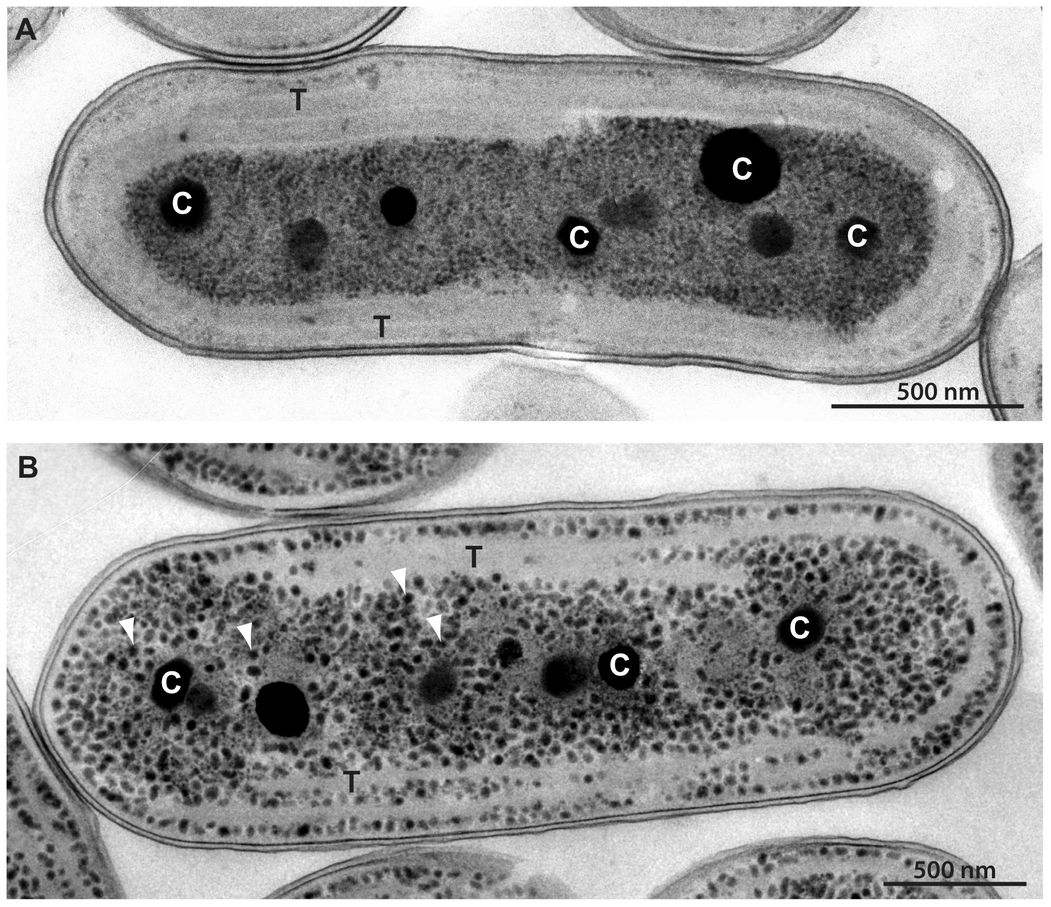 Electron micrographs of Synechococcus